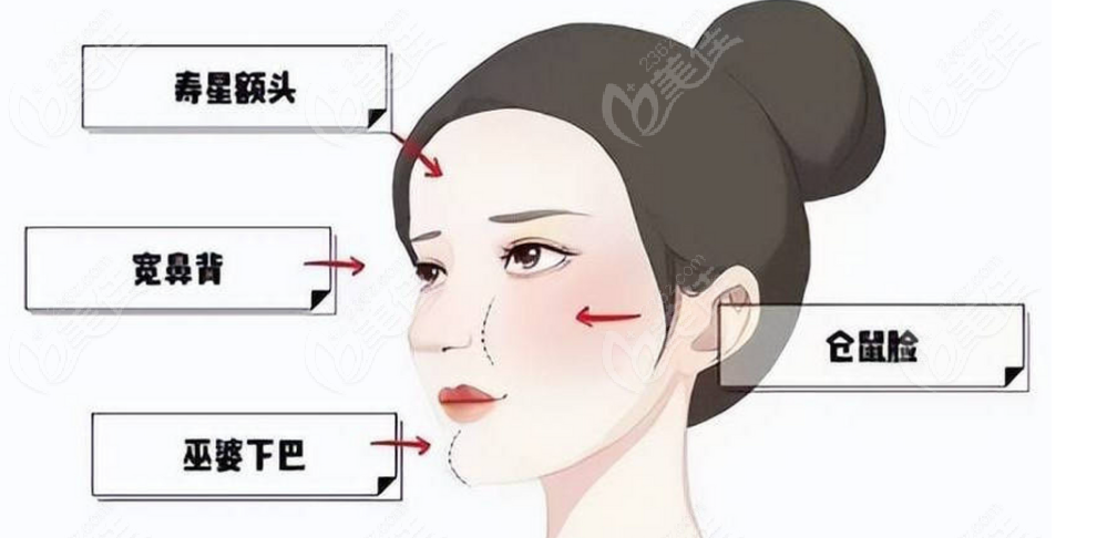 2025上海馒化脸修复医院Top5榜单医院脸部馒化修复好 2025上海馒化脸修复医院Top5榜单医院脸部馒化修复好