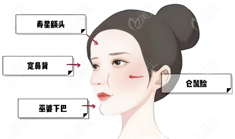 上海饅化臉修復中心地址電話