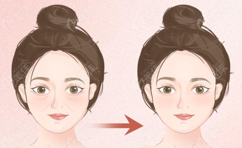 王阔远面部减容做得好 m.236z.com