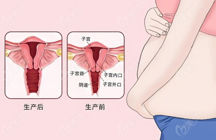 私密紧缩
