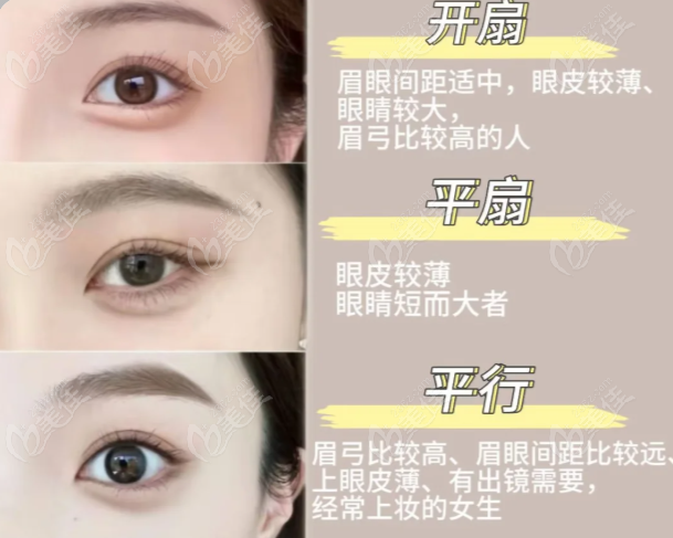 成都新华医院做双眼皮多少钱