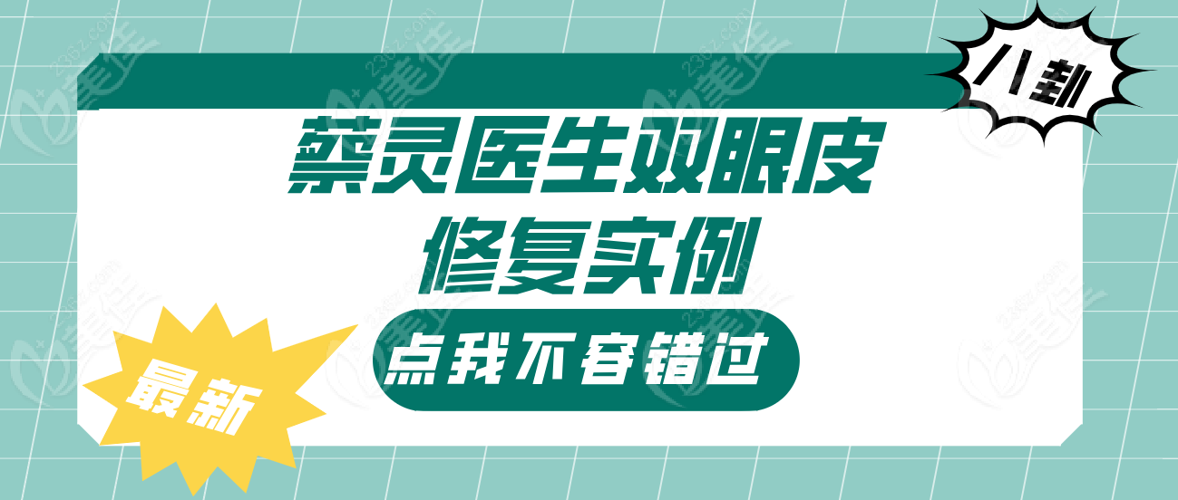蔡灵医生双眼皮修复实例分享