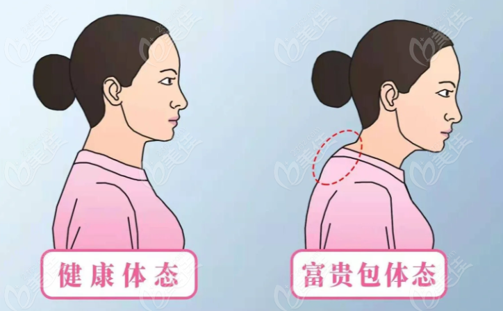何万华医生属于大佬水平