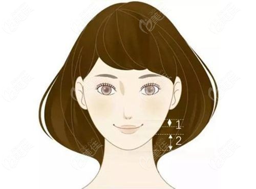 人中缩短术前后对比图片展示