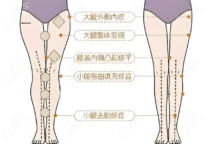 金尚訓(xùn)直腿術(shù)圖片
