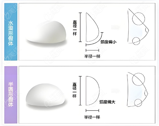 肖征刚假体隆胸技术好