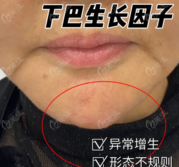 朱慧东面部异物取出技术好