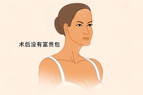没有富贵包.jpg