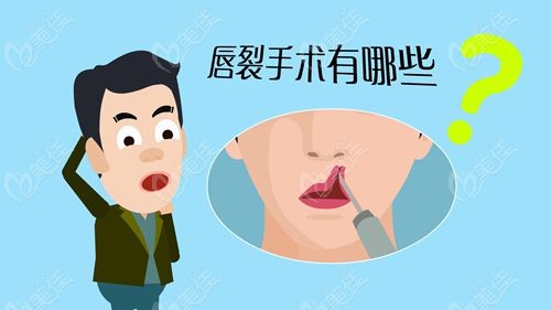 兔唇20岁修复二次大概多少钱