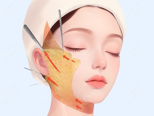 王志军拉皮医生是正规医生吗