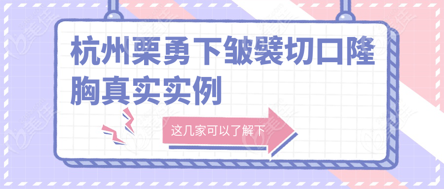 杭州栗勇下皱襞切口隆胸真实实例