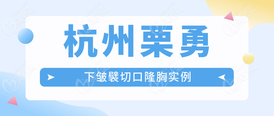 杭州栗勇下皱襞切口隆胸实例