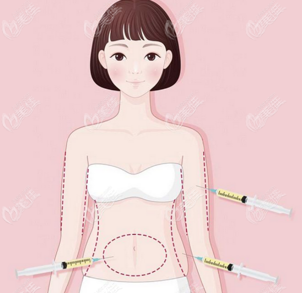 3S人魚體雕和5G天使光雕有什么區(qū)別