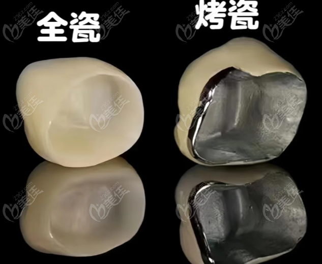 济南可恩口腔牙冠