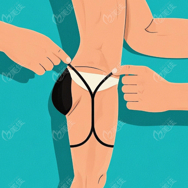 私密整形