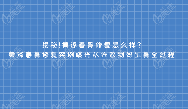 揭秘!黃澤春鼻修復(fù)怎么樣?黃澤春鼻修復(fù)實(shí)例曝光從失敗到媽生鼻全過程