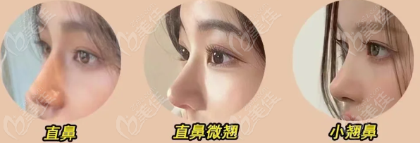 成都西区段焘擅长什么鼻型
