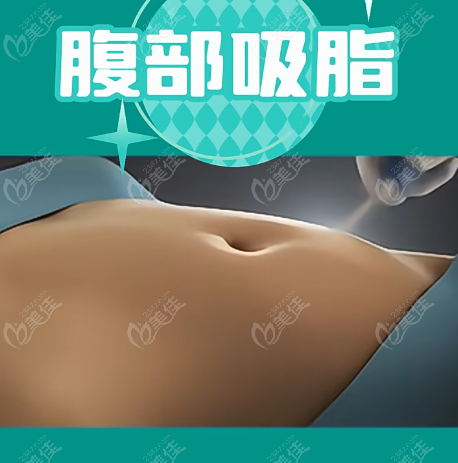 宋華敬吸脂實(shí)例