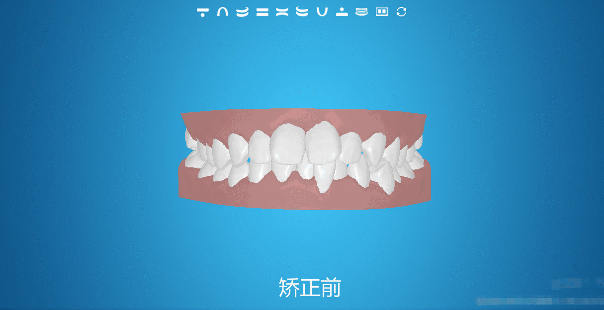 罗湖区隐形矫正