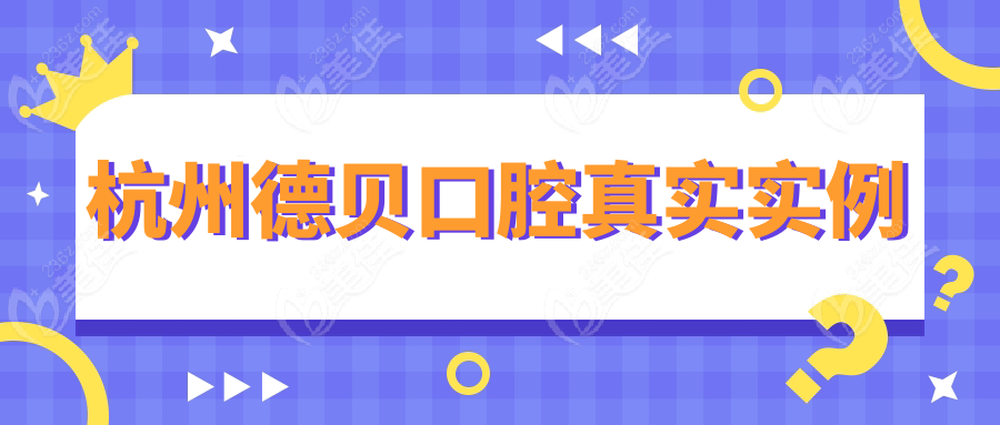 杭州德贝口腔真实实例