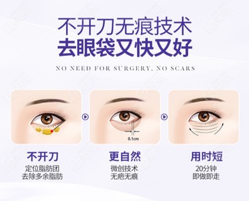 无锡去眼袋好的医院排名榜