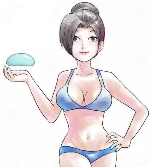 沈正宇曼托假体隆胸成效