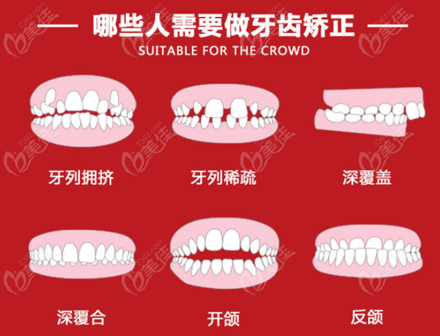 随州牙博仕口腔牙齿矫正多少钱？