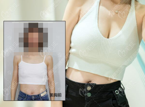 【沈阳百嘉丽黄金维纳斯美胸】职场达人亲测：乳晕隐痕+进口假体，穿职业装气场全开！
