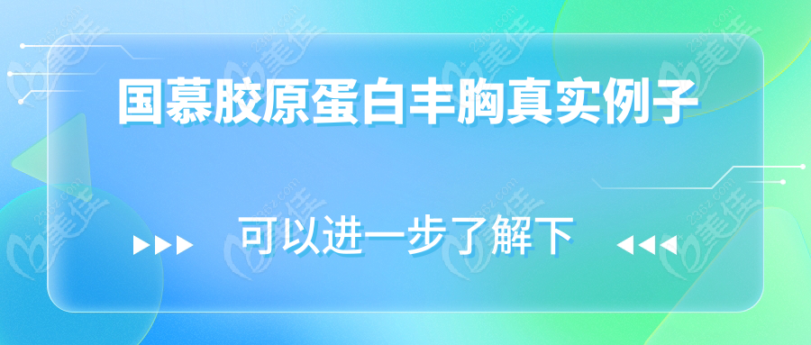 国慕胶原蛋白丰胸真实例子