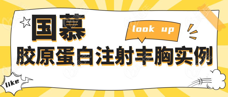 国慕胶原蛋白注射丰胸实例