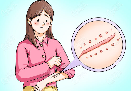 疤痕修复谷培俊医生怎么样？