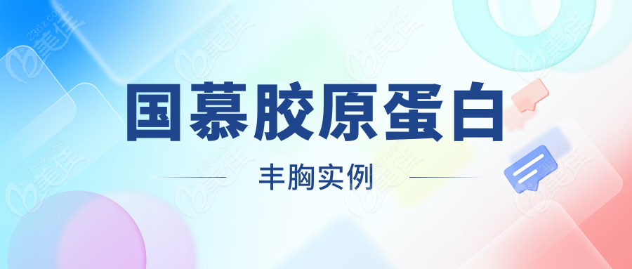 国慕胶原蛋白丰胸实例