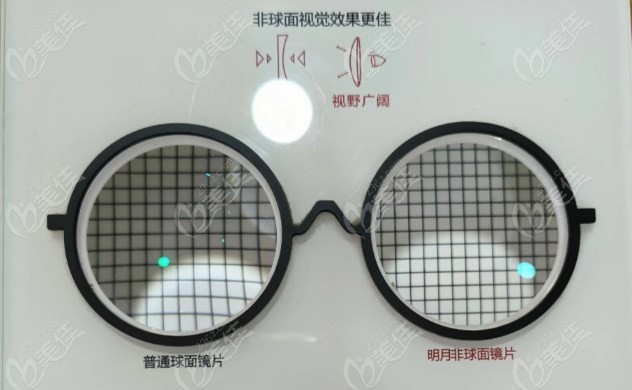 邢台爱尔眼科医院配眼镜