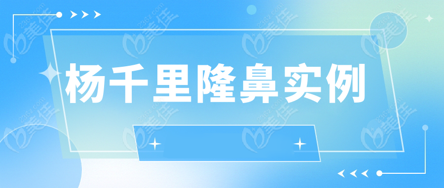 杨千里隆鼻实例