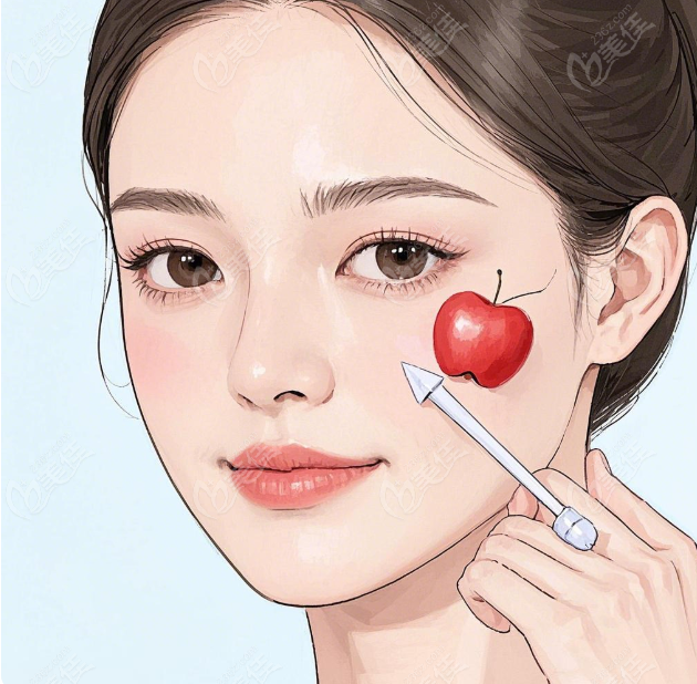 苹果肌复位提升www.236z.com