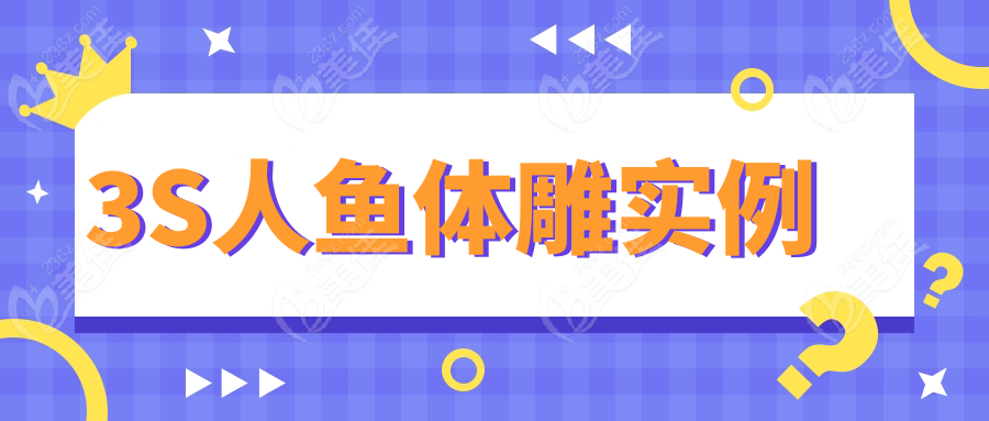 3S人魚體雕實例