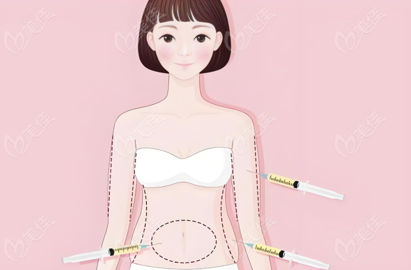 人鱼体雕大肚子成效真的好