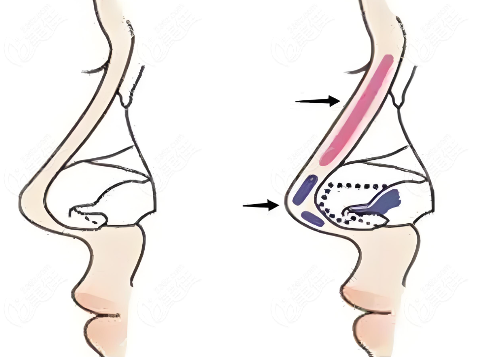 20250318_1742280761883014.png image.png