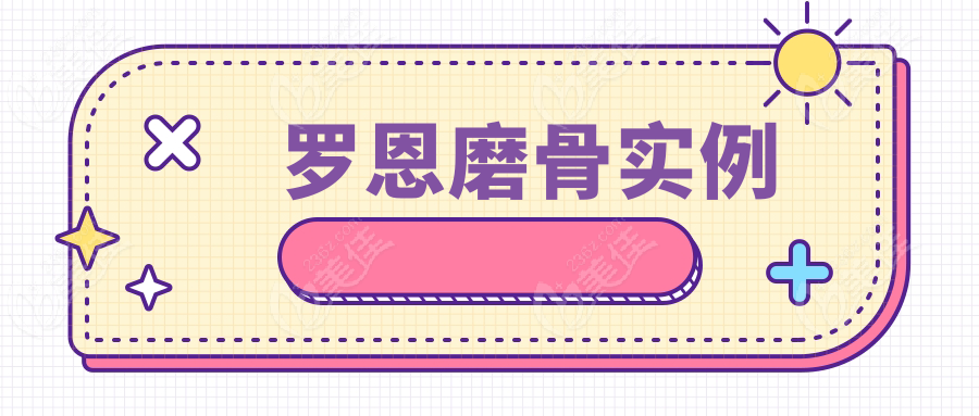 罗恩磨骨实例