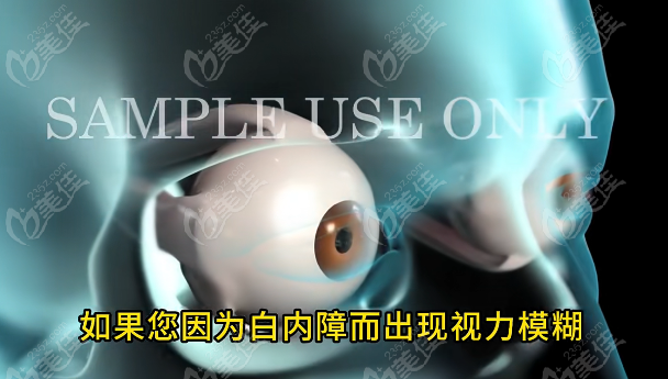 白內(nèi)障免費(fèi)治療政策到哪里申請