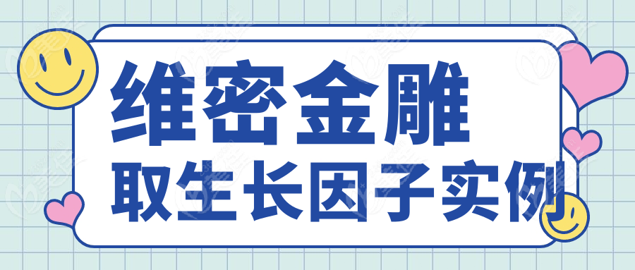 維密金雕取生長因子實例