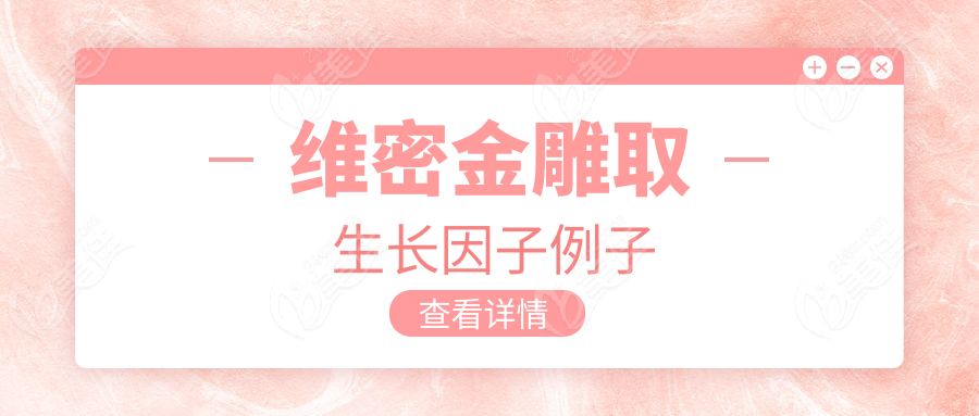 維密金雕取生長因子例子