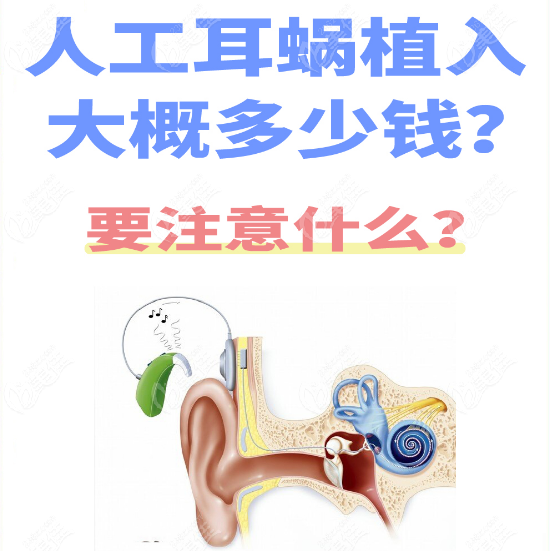 快讯：2025人工耳蜗价格暴跌75%！耳蜗植入后听力能和正常人一样吗？3大真相揭秘