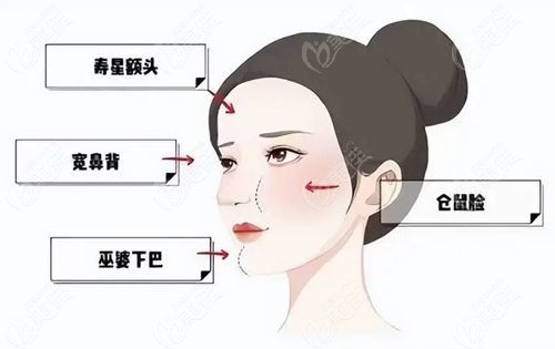 吴贞跃医生馒化脸修复怎么样