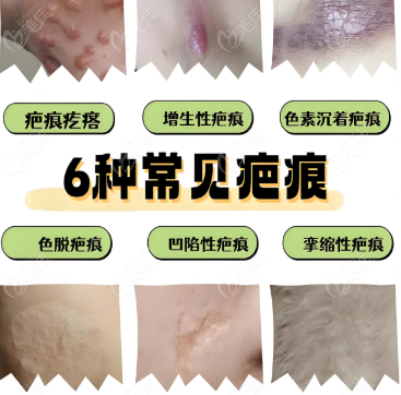 疤痕整形科