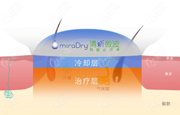 沈阳清新微波治疗腋臭的医院有哪些？