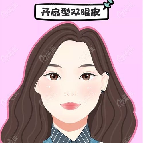 武汉方涛修复双眼皮近期实例
