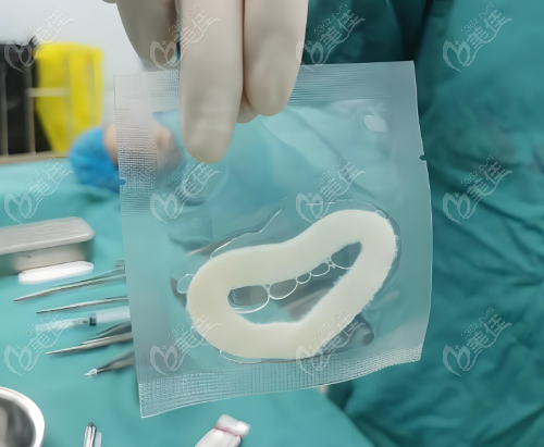 3D生物束带
