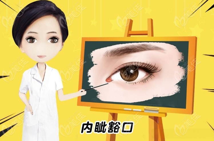 王恒内眼角修复价格不贵