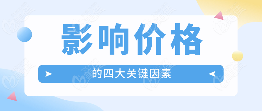 影响价格的四大关键因素